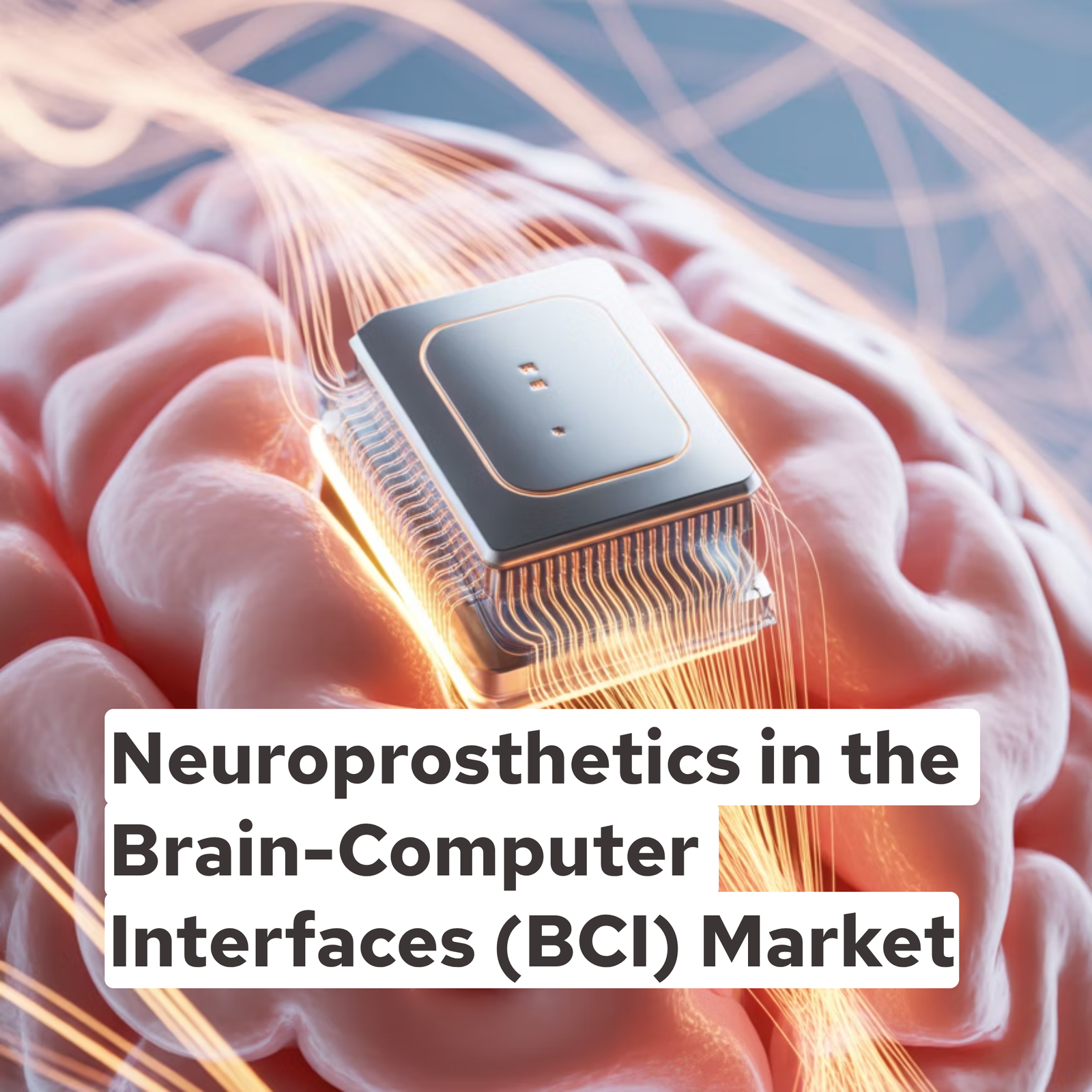 Neuroprosthetics in the Brain-Computer Interfaces (BCI) Market